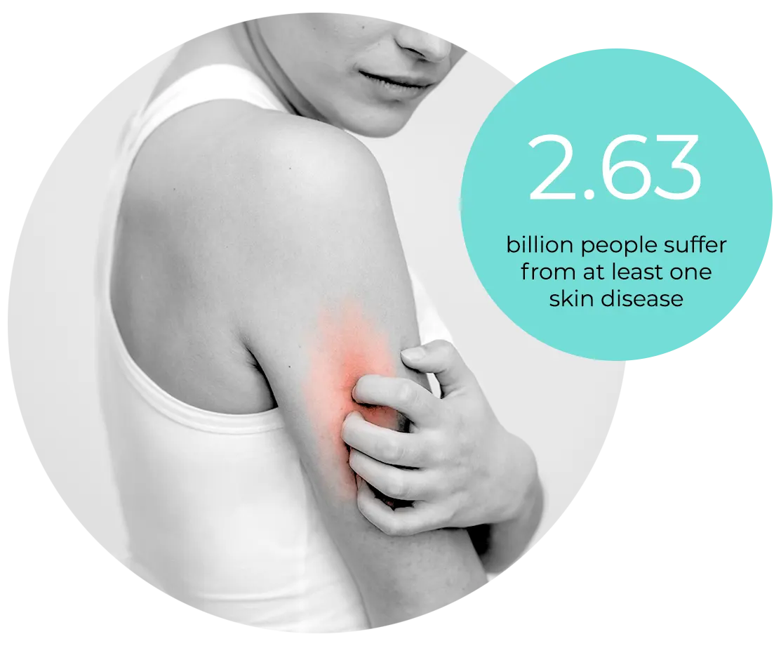 2.63 billion people suffer from at least one skin disease